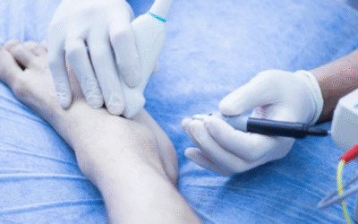 Rehabilitación podológica: Recuperación efectiva