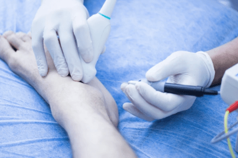 Rehabilitación podológica: Recuperación efectiva